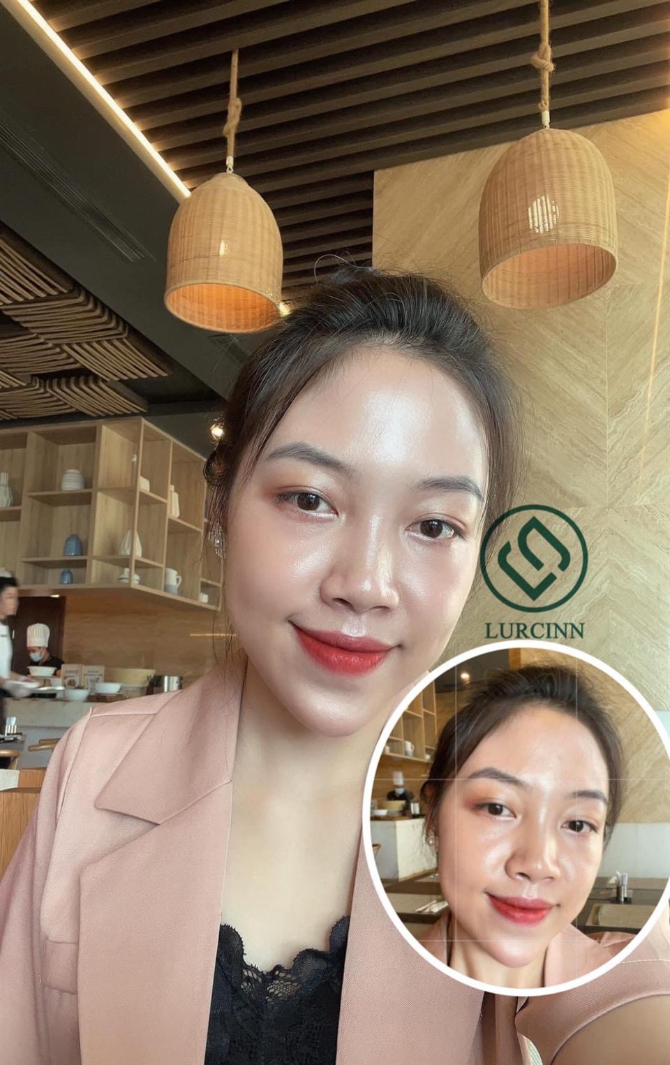 Ảnh khách hàng tự chụp làn da sau khi dùng, có logo Lurcinn